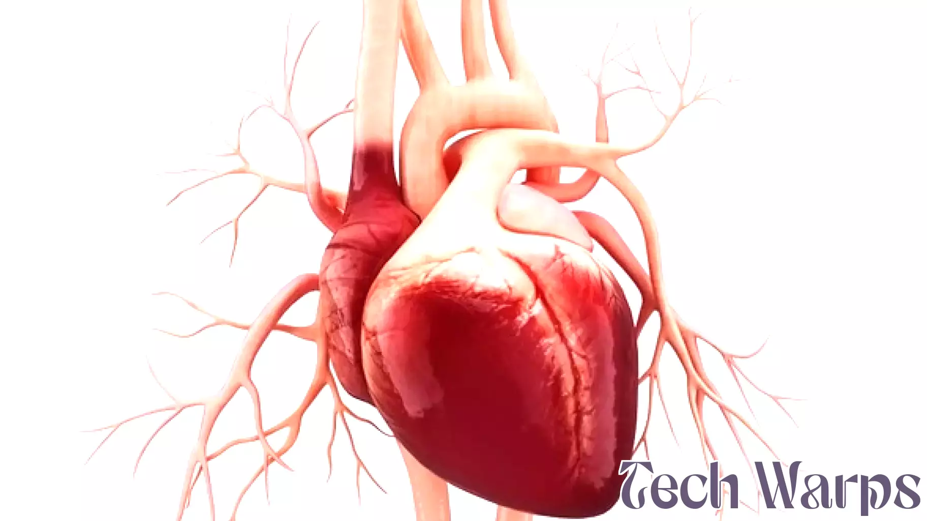 Breakthrough MRI Technology Enhances Aortic Stenosis Diagnosis